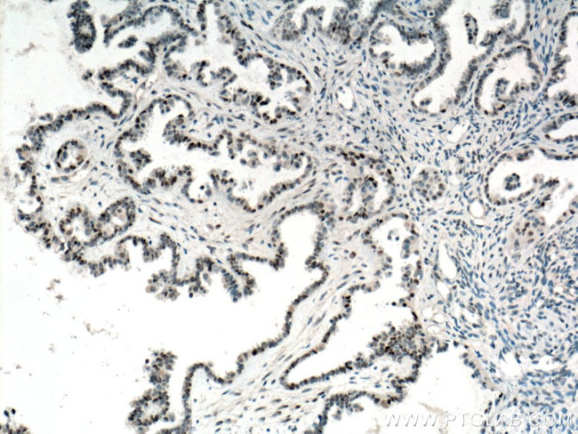 P53 Antibody in Immunohistochemistry (Paraffin) (IHC (P))