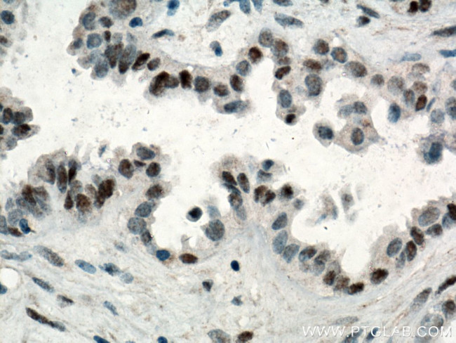 P53 Antibody in Immunohistochemistry (Paraffin) (IHC (P))