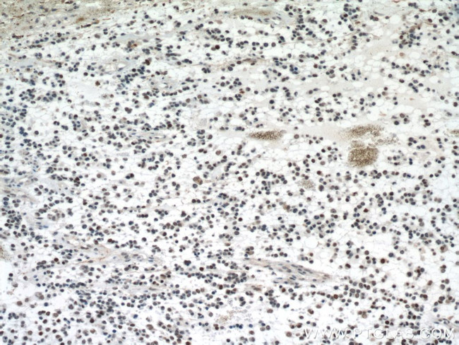 P53 Antibody in Immunohistochemistry (Paraffin) (IHC (P))