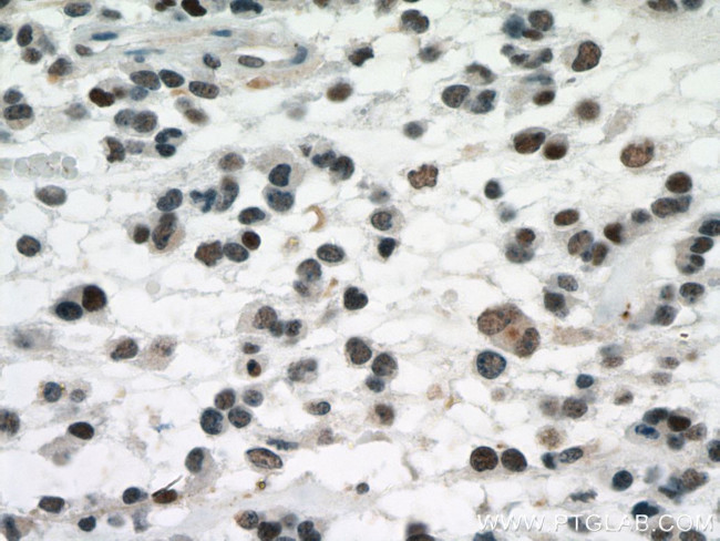 P53 Antibody in Immunohistochemistry (Paraffin) (IHC (P))