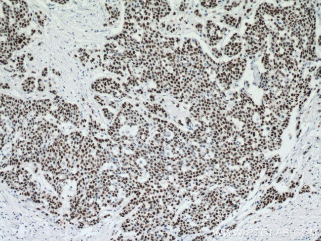 P53 Antibody in Immunohistochemistry (Paraffin) (IHC (P))