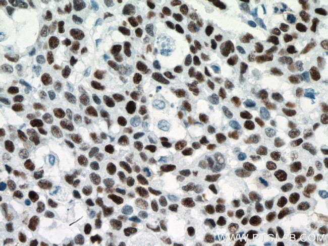 P53 Antibody in Immunohistochemistry (Paraffin) (IHC (P))