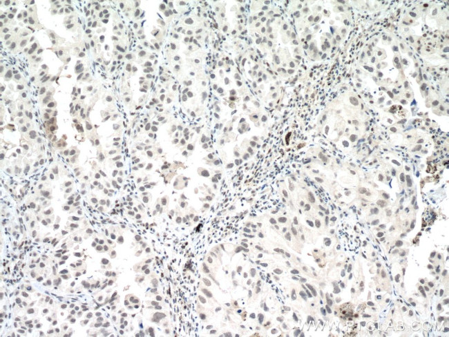 P53 Antibody in Immunohistochemistry (Paraffin) (IHC (P))