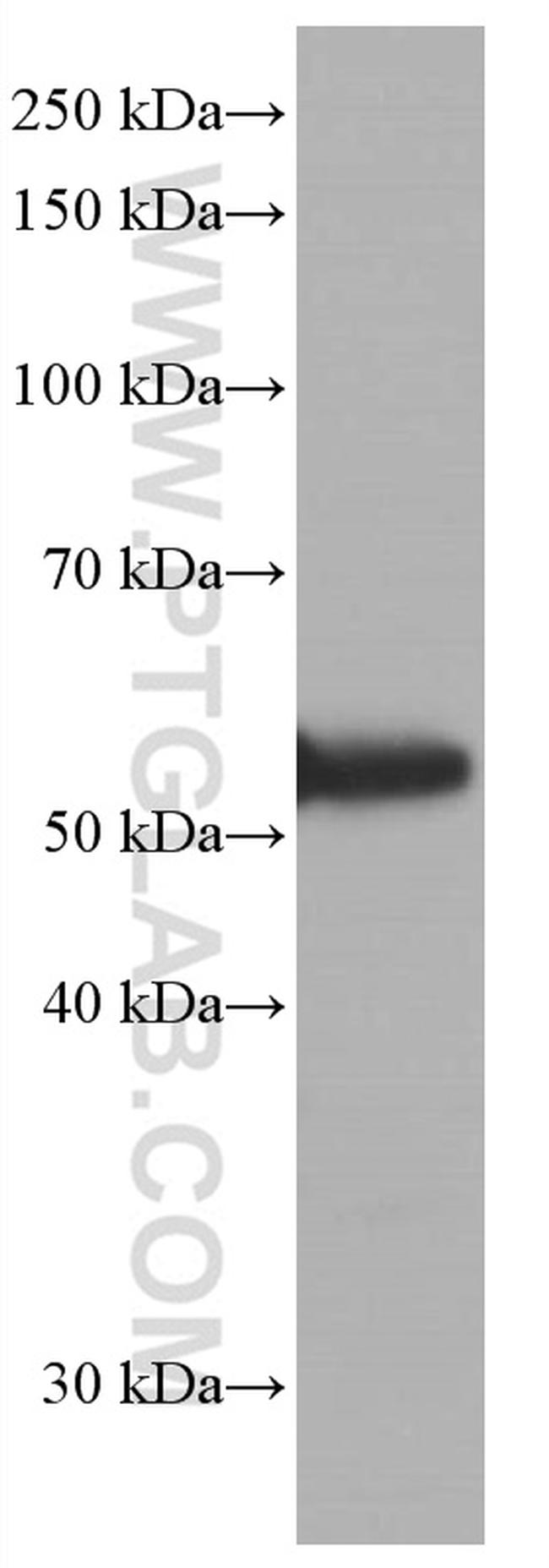 P53 Antibody in Western Blot (WB)