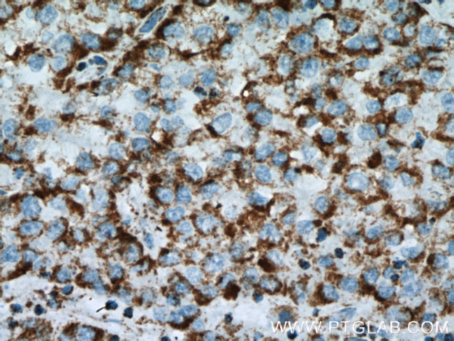 ATP5C1 Antibody in Immunohistochemistry (Paraffin) (IHC (P))