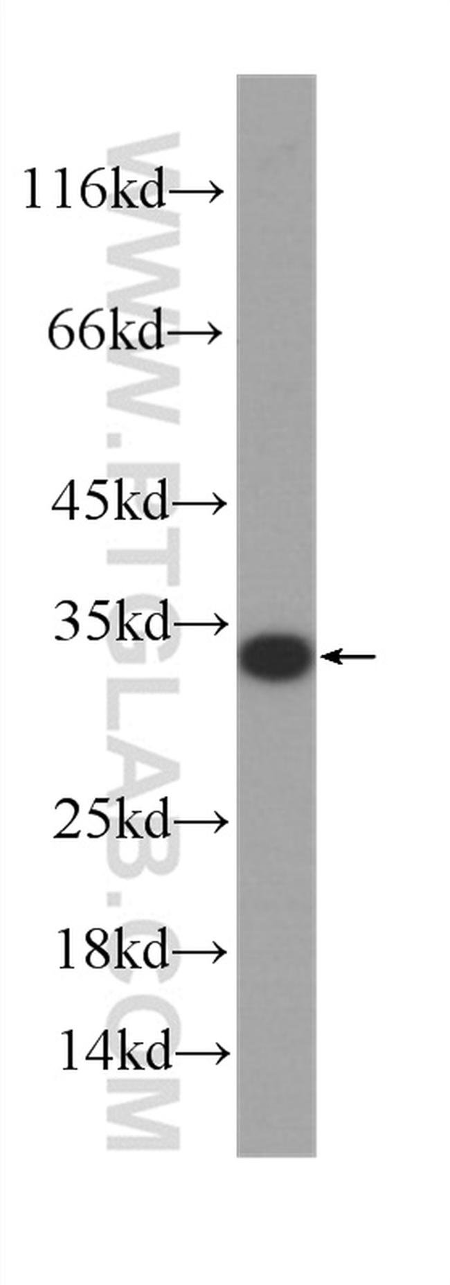 ATP5C1 Antibody in Western Blot (WB)