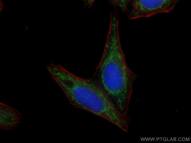 ATP5C1 Antibody in Immunocytochemistry (ICC/IF)