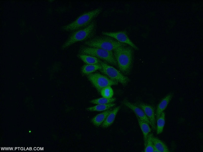 PRDX4 Antibody in Immunocytochemistry (ICC/IF)