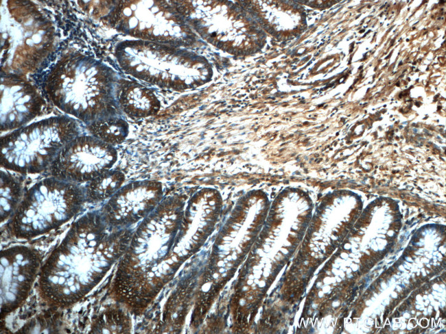 PRDX4 Antibody in Immunohistochemistry (Paraffin) (IHC (P))