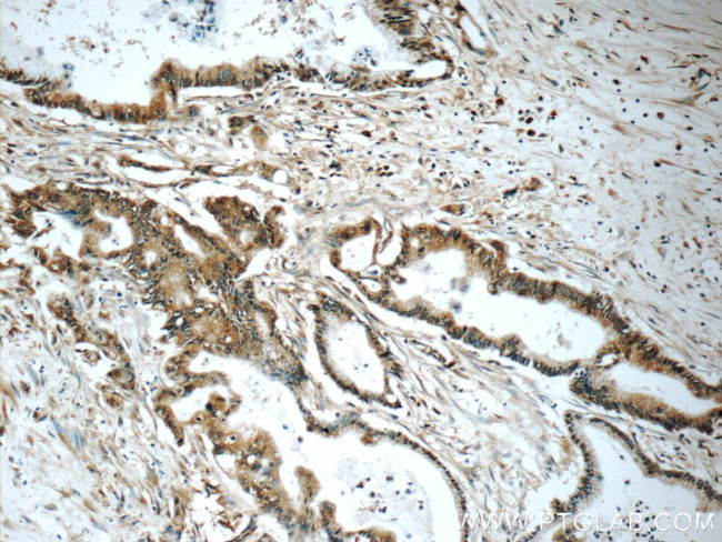 PRDX4 Antibody in Immunohistochemistry (Paraffin) (IHC (P))