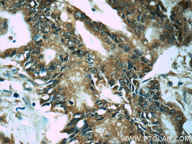 PRDX4 Antibody in Immunohistochemistry (Paraffin) (IHC (P))