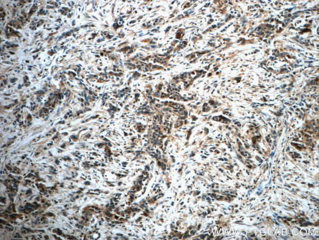 Annexin IV Antibody in Immunohistochemistry (Paraffin) (IHC (P))