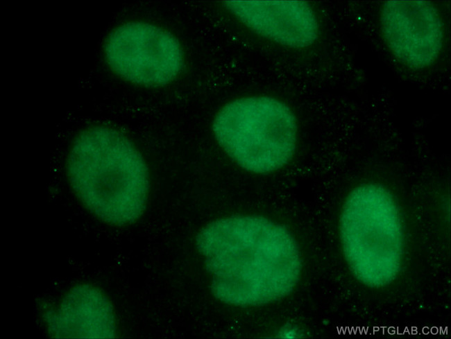 U2AF35 Antibody in Immunocytochemistry (ICC/IF)