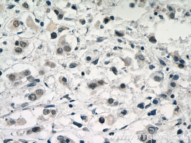 U2AF35 Antibody in Immunohistochemistry (Paraffin) (IHC (P))