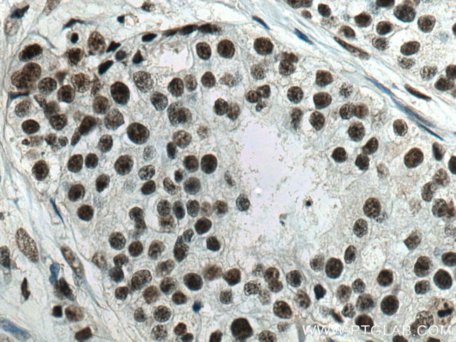 U2AF35 Antibody in Immunohistochemistry (Paraffin) (IHC (P))