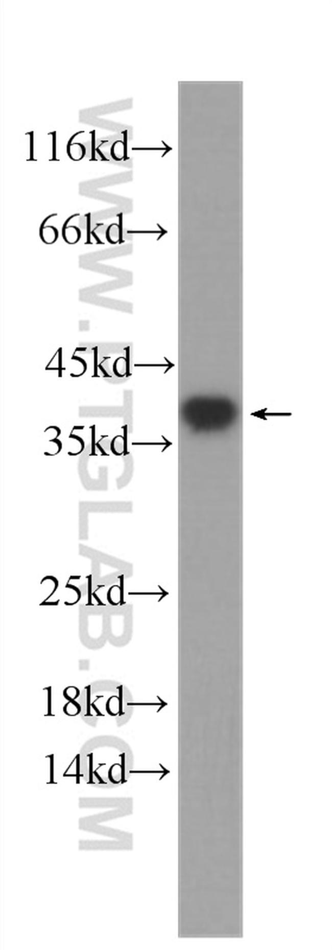 U2AF35 Antibody in Western Blot (WB)