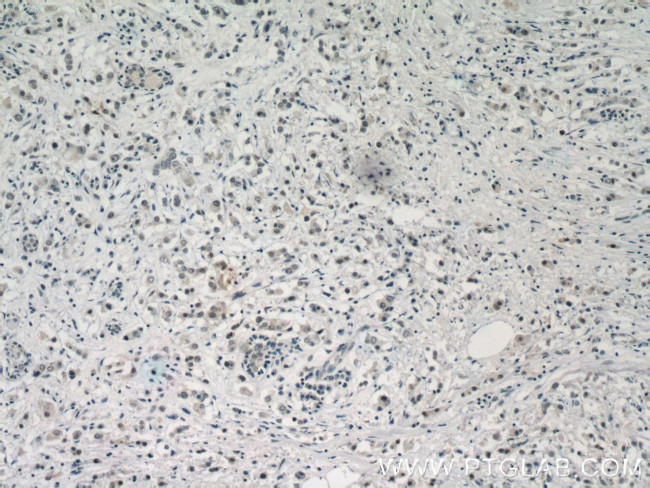 U2AF35 Antibody in Immunohistochemistry (Paraffin) (IHC (P))