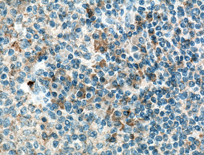 IL36 beta/IL1F8 Antibody in Immunohistochemistry (Paraffin) (IHC (P))