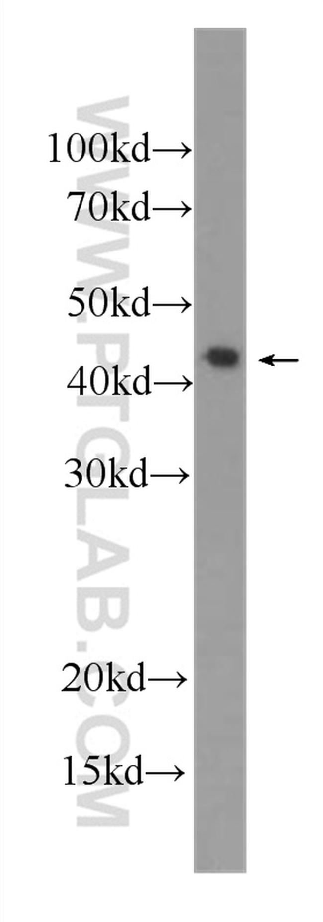 IL36 beta/IL1F8 Antibody in Western Blot (WB)