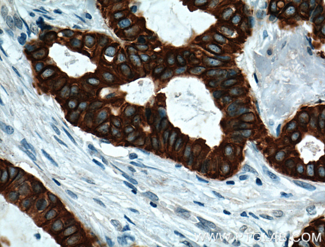 TNF alpha Antibody in Immunohistochemistry (Paraffin) (IHC (P))