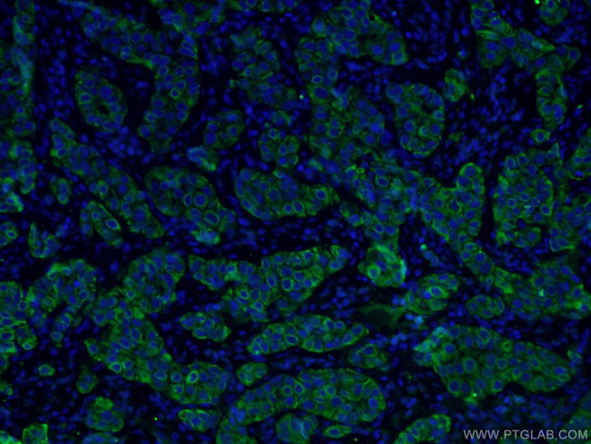 TNF alpha Antibody in Immunohistochemistry (PFA fixed) (IHC (PFA))