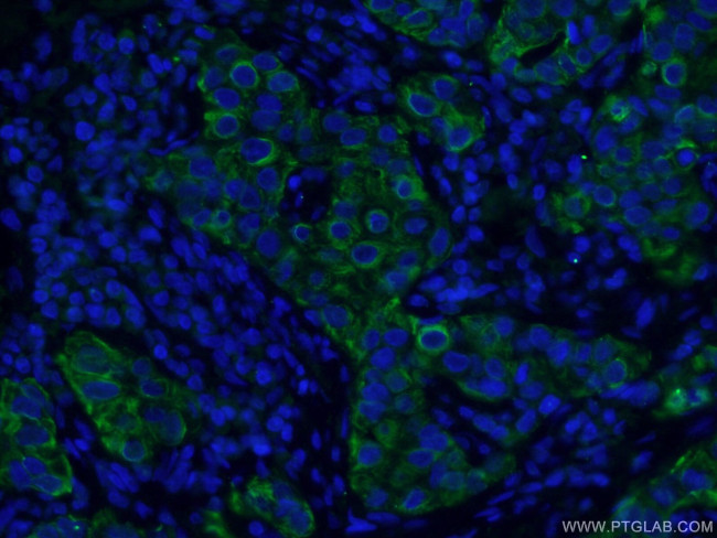 TNF alpha Antibody in Immunohistochemistry (PFA fixed) (IHC (PFA))