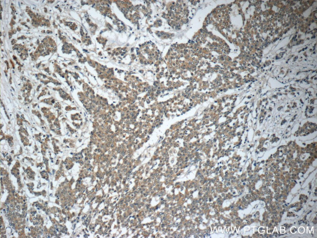 TNF alpha Antibody in Immunohistochemistry (Paraffin) (IHC (P))