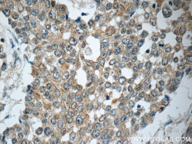 TNF alpha Antibody in Immunohistochemistry (Paraffin) (IHC (P))