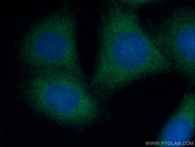 OPTN Antibody in Immunocytochemistry (ICC/IF)