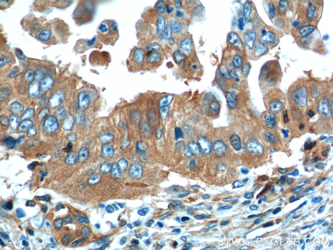 OPTN Antibody in Immunohistochemistry (Paraffin) (IHC (P))