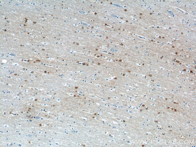 OPTN Antibody in Immunohistochemistry (Paraffin) (IHC (P))