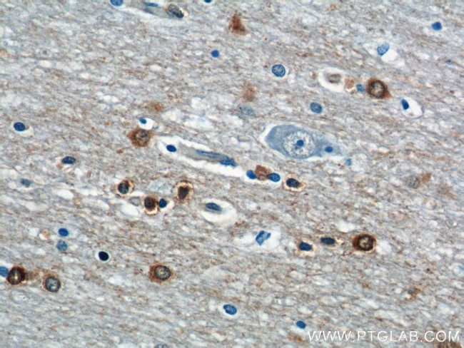 OPTN Antibody in Immunohistochemistry (Paraffin) (IHC (P))