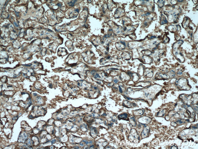 PLAP Antibody in Immunohistochemistry (Paraffin) (IHC (P))