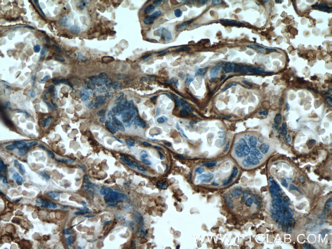 PLAP Antibody in Immunohistochemistry (Paraffin) (IHC (P))