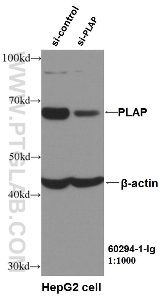 PLAP Antibody in Western Blot (WB)