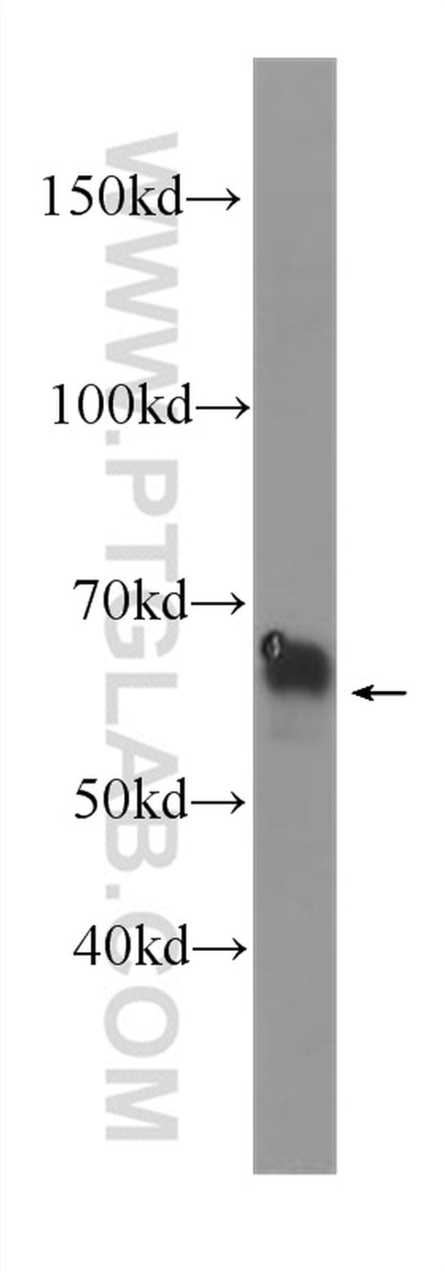 PLAP Antibody in Western Blot (WB)