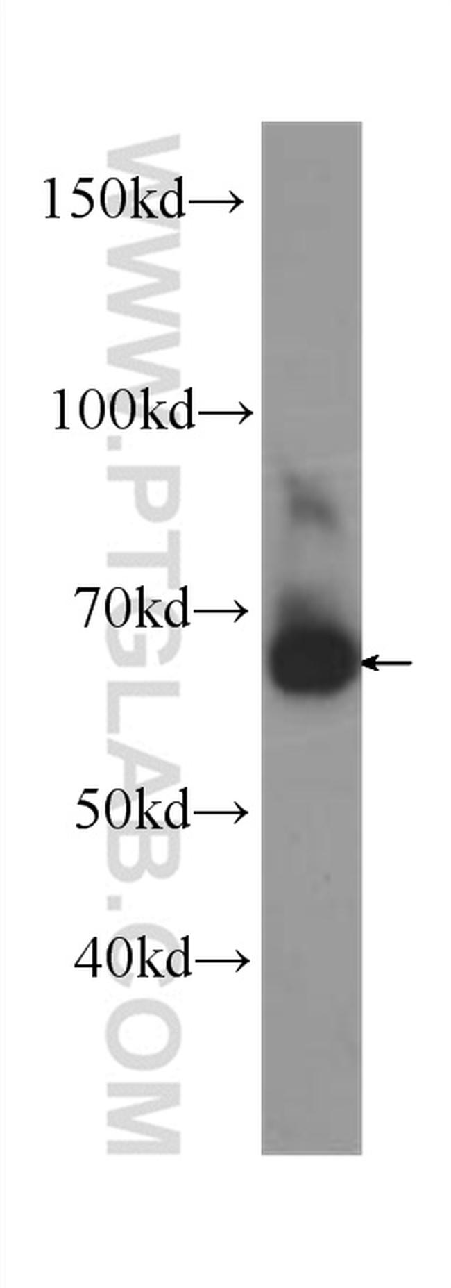 PLAP Antibody in Western Blot (WB)