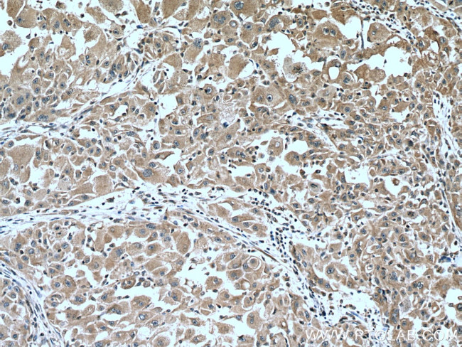 CYP2D6 Antibody in Immunohistochemistry (Paraffin) (IHC (P))