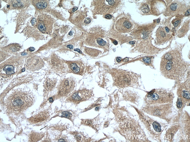 CYP2D6 Antibody in Immunohistochemistry (Paraffin) (IHC (P))