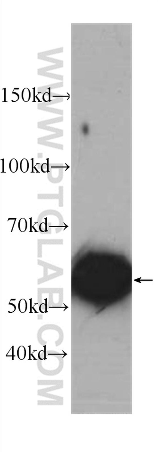 CYP2D6 Antibody in Western Blot (WB)