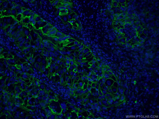 ICAM-1 Antibody in Immunohistochemistry (PFA fixed) (IHC (PFA))