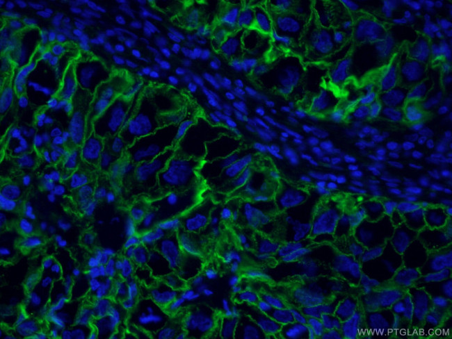 ICAM-1 Antibody in Immunohistochemistry (PFA fixed) (IHC (PFA))