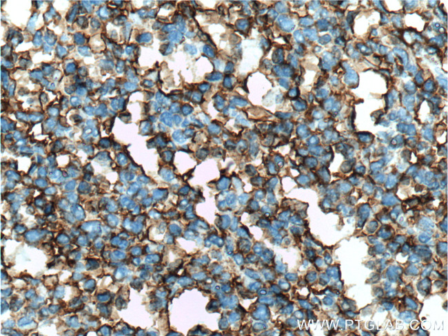 ICAM-1 Antibody in Immunohistochemistry (Paraffin) (IHC (P))