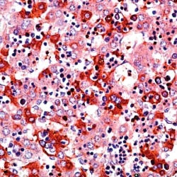 Alpha Fetoprotein (AFP) Antibody in Immunohistochemistry (Paraffin) (IHC (P))