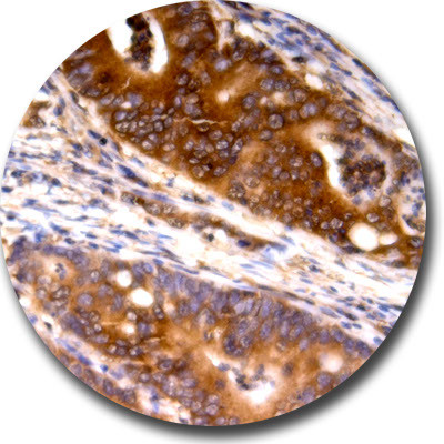 Ras Antibody in Immunohistochemistry (Paraffin) (IHC (P))