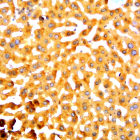 HBcAg Antibody in Immunohistochemistry (Paraffin) (IHC (P))