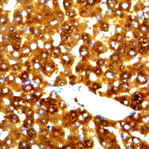 HBcAg Antibody in Immunohistochemistry (Paraffin) (IHC (P))