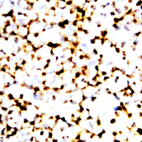 HCV envelope antigen Antibody in Immunocytochemistry (ICC/IF)