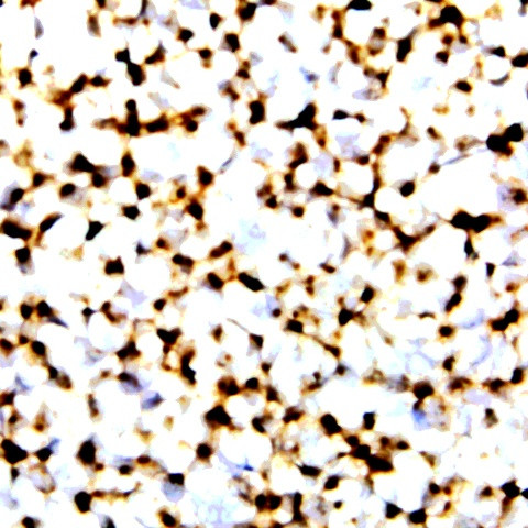 HIV LHPEYYK Antibody in Immunocytochemistry (ICC/IF)