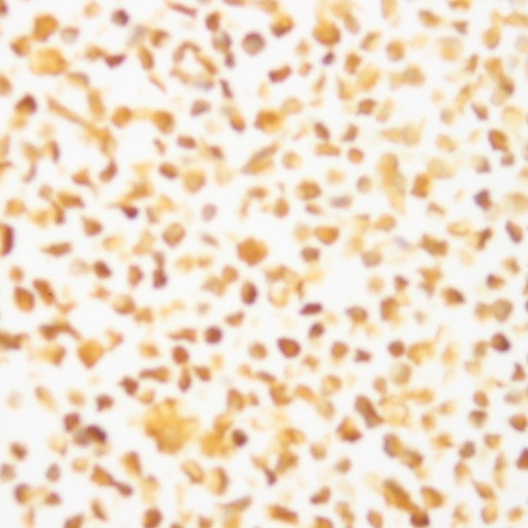 HIV p24 Antibody in Immunocytochemistry (ICC/IF)